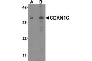 Western blot analysis of CDKN1C in 293 cell lysate with CDKN1C Antibody  at (A) 1 and (B) 2 μg/ml. (CDKN1C Antikörper  (N-Term))