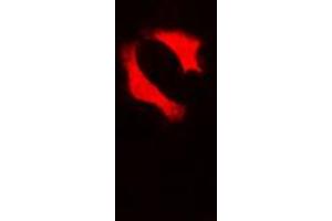 Immunofluorescent analysis of p53 staining in HepG2 cells.