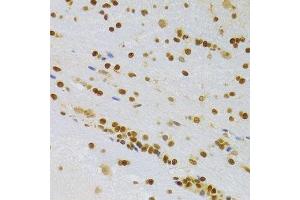 Immunohistochemistry of paraffin-embedded rat brain using HMGB1 Antibody. (HMGB1 Antikörper  (AA 100-200))