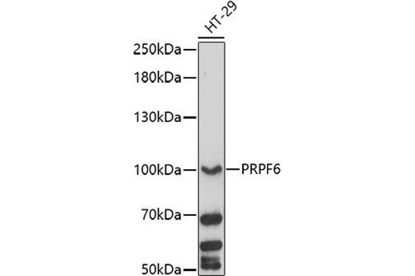 PRP6/ANT-1 antibody  (AA 592-941)