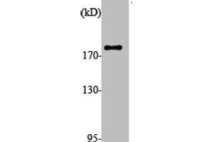 ALMS1 Antikörper  (Internal Region)