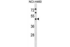 Western Blotting (WB) image for anti-Kaptin (Actin Binding Protein) (KPTN) antibody (ABIN2998936) (KPTN Antikörper)