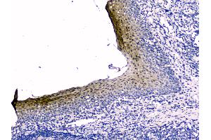 IHC analysis of Stefin B using anti-Stefin B antibody .