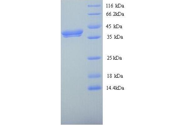WNT8A Protein (AA 23-358) (His tag)