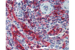 anti-HLA Class I Histocompatibility Antigen, alpha Chain E (HLA-E) antibody