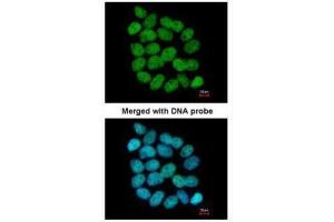 ICC/IF Image Immunofluorescence analysis of paraformaldehyde-fixed A431, using Bloom syndrome protein, antibody at 1:200 dilution. (BLM Antikörper  (C-Term))