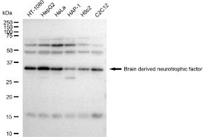 Western blotting analysis using Brain derived neurotrophic factor antibody (ABIN7797780).