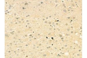 ABIN6263270 and ABIN6268834 at 1/100 staining human normal liver tissue by IHC-P. (DUSP1 Antikörper  (C-Term))