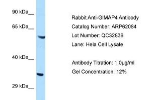 Western Blotting (WB) image for anti-GTPase, IMAP Family Member 4 (GIMAP4) (C-Term) antibody (ABIN2789011)