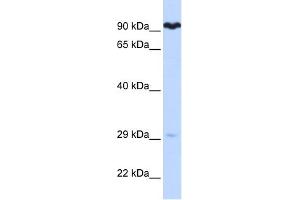 SUPV3L1 antibody used at 1 ug/ml to detect target protein. (SUPV3L1 Antikörper)