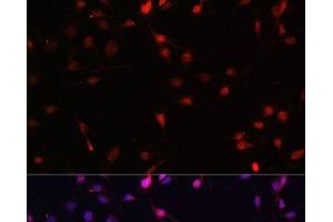 Immunofluorescence analysis of C6 cells using c-Fos Polyclonal Antibody at dilution of 1:100. (c-FOS Antikörper)