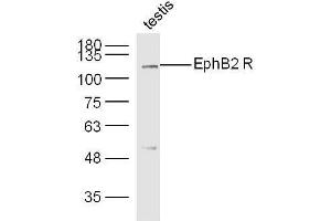 Mouse testis lysates probed with Rabbit Anti-EphB2 R Polyclonal Antibody, Unconjugated  at 1:300 overnight at 4˚C. (EphB2 R (AA 101-200) Antikörper)
