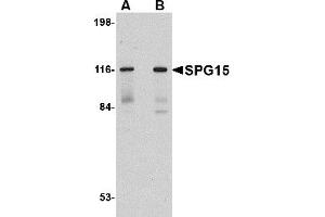 Western Blotting (WB) image for anti-Zinc Finger, FYVE Domain Containing 26 (ZFYVE26) (C-Term) antibody (ABIN1030693) (ZFYVE26 Antikörper  (C-Term))