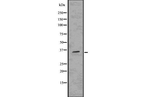 SIX2 Antikörper  (Internal Region)