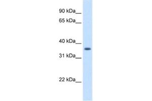 Western Blotting (WB) image for anti-Aldo-Keto Reductase Family 1, Member B10 (Aldose Reductase) (AKR1B10) antibody (ABIN2462603) (AKR1B10 Antikörper)