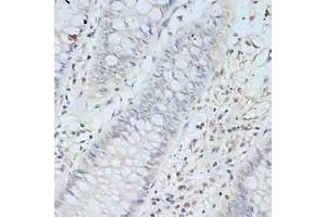Immunohistochemistry of paraffin-embedded human colon using TCEB2 antibody (ABIN6131621, ABIN6148934, ABIN6148936 and ABIN6217328) at dilution of 1:100 (40x lens). (TCEB2 Antikörper  (AA 1-118))
