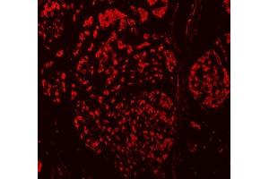 IF analysis of TBX18 using anti-TBX18 antibody (ABIN7599494).