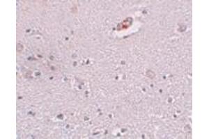 Immunohistochemistry (IHC) image for anti-Zinc Finger Protein 536 (ZNF536) (N-Term) antibody (ABIN1031687)