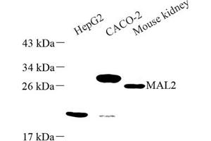 Western blot analysis of MAL2 (ABIN7074549) at dilution of 1: 500 (MAL2 Antikörper)
