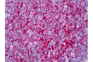 Anti-CR2 / CD21 antibody IHC of human tonsil, germinal center. (CD21 Antikörper)
