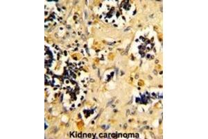 Immunohistochemistry (IHC) image for anti-NADH Dehydrogenase (Ubiquinone) Fe-S Protein 4, 18kDa (NADH-Coenzyme Q Reductase) (NDUFS4) antibody (ABIN3002889)