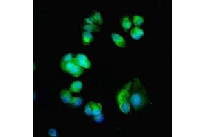 Immunofluorescent analysis of MCF-7 cells using ABIN7175612 at dilution of 1:100 and Alexa Fluor 488-congugated AffiniPure Goat Anti-Rabbit IgG(H+L) (CACNA1H Antikörper  (AA 260-360))