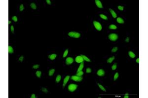 Immunofluorescence of purified MaxPab antibody to RNF25 on HeLa cell. (RNF25 Antikörper  (AA 1-459))