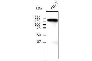 Endogenous CD45 detected With ABOIOO at 1/500 dilution, lysate at 100 µg per Iane and rabbit polyclonal to goat lµg (HRP) at 2/10,000 dilution,