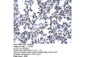 Human Lung (GCM1 Antikörper  (N-Term))