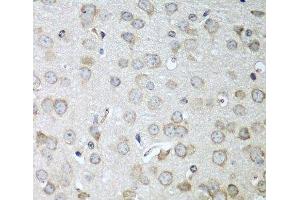 Immunohistochemistry of paraffin-embedded Mouse brain using CDH11 Polyclonal Antibody at dilution of 1:100 (40x lens). (OB Cadherin Antikörper)