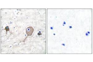 Immunohistochemistry (IHC) image for anti-Enolase 2 (Gamma, Neuronal) (ENO2) (C-Term) antibody (ABIN1848702) (ENO2/NSE Antikörper  (C-Term))