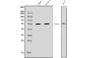 Western blot analysis of FOXJ1 using anti-FOXJ1 antibody (ABIN7601015).