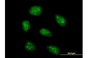 Immunofluorescence of purified MaxPab antibody to AIM2 on HeLa cell.