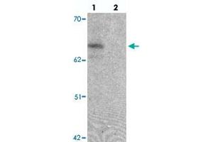 Western blot analysis of ZGPAT in SK-N-SH cell lysate with ZGPAT polyclonal antibody  at 1 ug/mL in (lane 1) the absence and (lane 2) the presence of blocking peptide. (ZGPAT Antikörper  (C-Term))