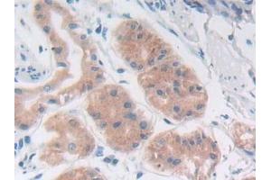 Immunohistochemistry (IHC) image for anti-Acid Phosphatase, Prostate (ACPP) (AA 217-386) antibody (ABIN7431248)