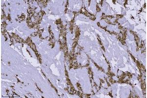 IHC analysis of Annexin-4/ANXA4 using anti-Annexin-4/ANXA4 antibody (ABIN7599265). (Annexin IV Antikörper  (AA 1-319))