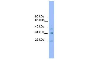 Western Blot showing RNF167 antibody used at a concentration of 1-2 ug/ml to detect its target protein.