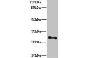 Western blot All lanes: ICAM4 antibody at 4. (ICAM4 Antikörper  (AA 20-140))