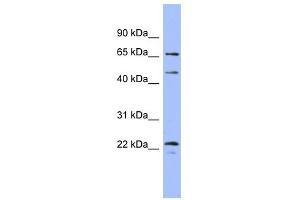 MAPK4 antibody used at 1 ug/ml to detect target protein.