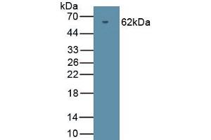 Detection of Recombinant PRKG2, Human using Polyclonal Antibody to Protein Kinase, cGMP Dependent Type II (PRKG2) (PRKG2 Antikörper  (AA 453-728))