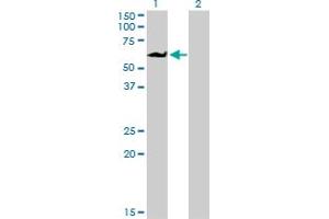 Western Blotting (WB) image for anti-Eukaryotic Translation Initiation Factor 4 gamma 3 (EIF4G3) (AA 1-516) antibody (ABIN599055) (EIF4G3 Antikörper  (AA 1-516))