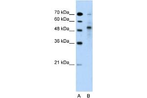 WB Suggested Anti-TRIM59 Antibody Titration:  5. (TRIM59 Antikörper  (Middle Region))