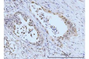 IHC analysis of SBNO1 using anti-SBNO1 antibody (ABIN7601710). (SBNO1 Antikörper  (AA 43-1303))