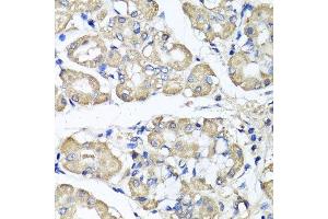 Immunohistochemistry of paraffin-embedded human stomach using BCS1L antibody. (BCS1L Antikörper  (AA 33-240))