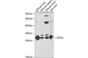 Western blot analysis of extracts of various cell lines, using STOM antibody (ABIN6132877, ABIN6148626, ABIN6148628 and ABIN6221992) at 1:1000 dilution. (Stomatin Antikörper  (AA 55-288))
