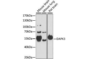 Western blot analysis of extracts of various cell lines, using D antibody (ABIN7266712) at 1:1000 dilution. (DAPK3 Antikörper  (AA 1-100))