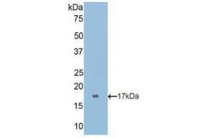 Western blot analysis of recombinant Rat CUBN. (CUBN Antikörper  (AA 3157-3274))