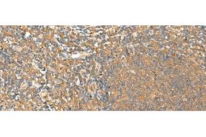 Immunohistochemistry of paraffin-embedded Human tonsil tissue using HTT Polyclonal Antibody at dilution of 1:25(x200) (Huntingtin Antikörper)