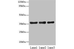 Western blot All lanes: UPP2 antibody at 4 μg/mL Lane 1: Mouse kidney tissue Lane 2: Mouse brain tissue Lane 3: Hela whole cell lysate Secondary Goat polyclonal to rabbit IgG at 1/10000 dilution Predicted band size: 36, 42 kDa Observed band size: 36 kDa (UPP2 Antikörper  (AA 1-317))