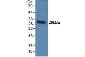 Detection of Recombinant TLR5, Human using Polyclonal Antibody to Toll Like Receptor 5 (TLR5) (TLR5 Antikörper  (AA 303-514))